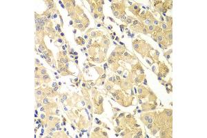 Immunohistochemistry of paraffin-embedded human gastric using PDCD2L antibody at dilution of 1:100 (x400 lens). (PDCD2L 抗体)