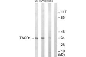 Western blot analysis of extracts from Jurkat/HuvEc/COLO205 cells, using TACD1 Antibody. (TACD1 (AA 116-165) 抗体)