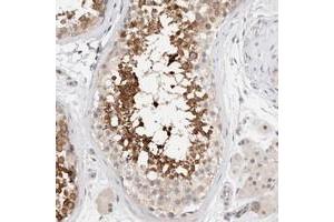 Immunohistochemical staining of human testis with C17orf97 polyclonal antibody  shows strong cytoplasmic positivity in subsets of seminiferus duct cells. (LIAT1/C17orf97 抗体)