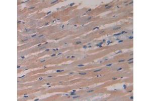 Used in DAB staining on fromalin fixed paraffin- embedded heart tissue (DMPK 抗体  (AA 1-152))