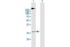 Western Blot analysis of TMEM38A expression in transfected 293T cell line by TMEM38A MaxPab polyclonal antibody. (TMEM38A 抗体  (AA 1-299))