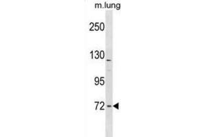 Western Blotting (WB) image for anti-Formin Binding Protein 1-Like (FNBP1L) antibody (ABIN2998844) (FNBP1L 抗体)