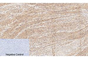 Immunohistochemical analysis of paraffin-embedded human uterus tissue.