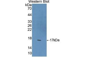 Detection of Recombinant PPARg, Mouse using Polyclonal Antibody to Peroxisome Proliferator Activated Receptor Gamma (PPARg) (PPARG 抗体  (AA 149-273))