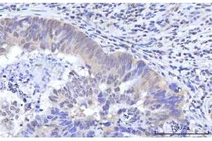 IHC analysis of RBM22 using anti-RBM22 antibody (ABIN7600268).