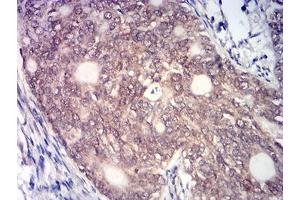 Immunohistochemistry (IHC) image for anti-MYST Histone Acetyltransferase 2 (MYST2) (AA 1-200) antibody (ABIN7193385)