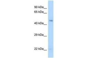 Image no. 1 for anti-Guanine Deaminase (GDA) (AA 30-79) antibody (ABIN6748002)