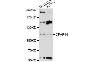 Western blot analysis of extracts of various cell lines, using CFAP44 antibody (ABIN6290455) at 1:3000 dilution. (WDR52 抗体)