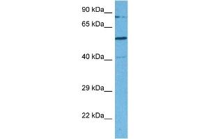 Host:  Rabbit  Target Name:  SMARCD2  Sample Tissue:  Human MDA-MB-435s Whole Cell  Antibody Dilution:  1ug/ml (SMARCD2 抗体  (C-Term))