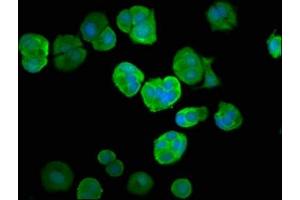 Immunofluorescence staining of MCF-7 cells with ABIN7174409 at 1:66, counter-stained with DAPI. (UBA52 抗体  (AA 1-128))