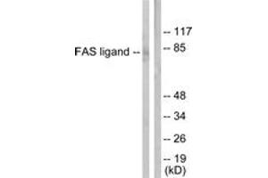Western blot analysis of extracts from 293 cells, using FAS ligand Antibody. (FASL 抗体  (AA 101-150))