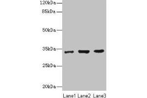 Western blot All lanes: NAPA antibody at 7 μg/mL Lane 1: 293T whole cell lysate Lane 2: Hela whole cell lysate Lane 3: K562 whole cell lysate Secondary Goat polyclonal to rabbit IgG at 1/10000 dilution Predicted band size: 34 kDa Observed band size: 34 kDa (NAPA 抗体  (AA 1-295))