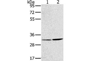 Western blot analysis of A172 and A375 cell, using HSD17B12 Polyclonal Antibody at dilution of 1:650 (HSD17B12 抗体)