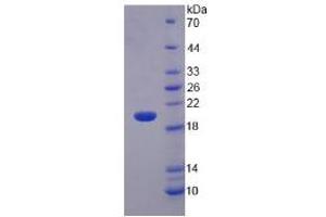 SDS-PAGE analysis of Rat Matrix Metalloproteinase 3 (MMP3) Protein. (MMP3 蛋白)