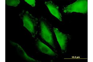 Immunofluorescence of monoclonal antibody to IBRDC1 on HepG2 cell. (RNF217 抗体  (AA 2-100))