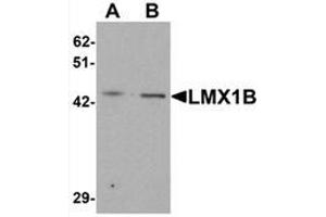 Western blot analysis of LMX1B in A-20 cell lysate with LMX1B Antibody  at (A) 1 and (B) 2 μg/mL (LMX1B 抗体  (C-Term))