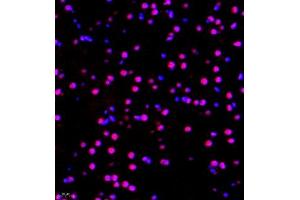 Immunofluorescence of paraffin embedded mouse brain using RBAK (ABIN7075383) at dilution of 1:400 (400x lens) (RBAK 抗体)