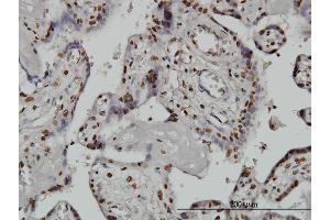 Immunoperoxidase of monoclonal antibody to ARID1B on formalin-fixed paraffin-embedded human placenta. (ARID1B 抗体  (AA 1364-1460))