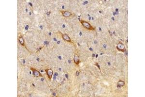 Immunohistochemistry (IHC) image for anti-Cannabinoid Receptor 2 (CNR2) (AA 329-356) antibody (ABIN3030275)