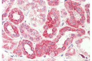 Rabbit Anti-DLST antibody Catalog Number: ARP61476 Formalin Fixed Paraffin Embedded Tissue: Human Kidney Primary antibody Concentration: 1:200 Secondary Antibody: Donkey anti-Rabbit-Cy3 Secondary Antibody Concentration: 1:200 Magnification: 20x Exposure Time: 0. (DLST 抗体  (C-Term))