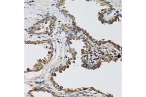 Immunohistochemistry of paraffin-embedded human prostate using IL25 antibody at dilution of 1:100 (40x lens). (IL-25 抗体)