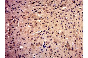 Immunohistochemistry (Paraffin-embedded Sections) (IHC (p)) image for anti-Met Proto-Oncogene (MET) (AA 25-150) antibody (ABIN671661)