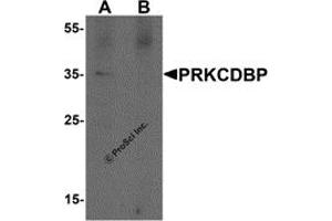 Western Blotting (WB) image for anti-Protein Kinase C, delta Binding Protein (PRKCDBP) antibody (ABIN1077454) (PRKCDBP 抗体)