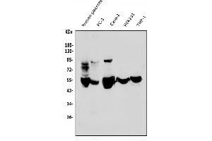 Western blot analysis of MMP1 using anti-MMP1 antibody (ABIN3043405).