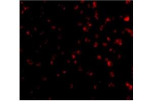 Immunofluorescence of TIM-4 in Jurkat cells with TIM-4 antibody at 20 µg/ml. (TIMD4 抗体  (Center))