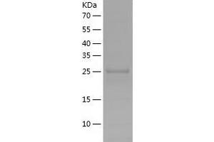 Western Blotting (WB) image for phosphoglycerate Mutase 1 (Brain) (PGAM1) (AA 1-254) protein (His tag) (ABIN7124421)