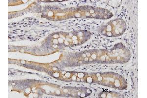 Immunoperoxidase of monoclonal antibody to LIAS on formalin-fixed paraffin-embedded human small Intestine. (LIAS 抗体  (AA 273-372))