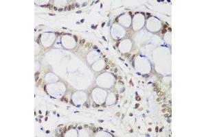 Immunohistochemistry of paraffin-embedded human gastric using CBX3 antibody. (CBX3 抗体)