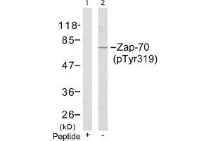 Western blot analysis of extracts from Jurkat cells using Zap-70(Phospho-Tyr319) Antibody(Lane 2) and the same antibody preincubated with blocking peptide(Lane1). (ZAP7 (pTyr319) 抗体)