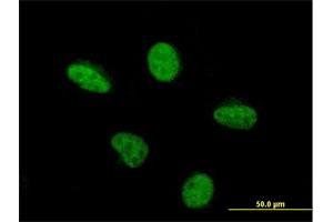 Immunofluorescence (IF) image for anti-K(lysine) Acetyltransferase 2B (KAT2B) (AA 353-452) antibody (ABIN522308)