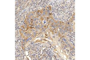 IHC analysis of OAT3/SLC22A8 using anti-OAT3/SLC22A8 antibody (ABIN7599422).