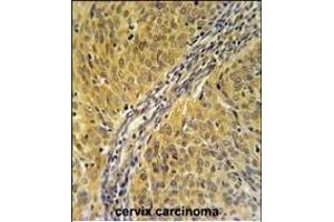 Immunohistochemistry (Paraffin-embedded Sections) (IHC (p)) image for anti-Dynein, Cytoplasmic 1, Light Intermediate Chain 2 (DYNC1LI2) (AA 152-180) antibody (ABIN651669)
