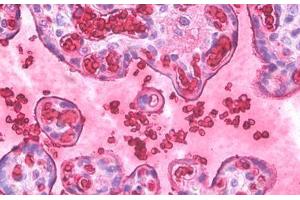 Anti-Hemoglobin antibody IHC staining of human placenta, erythrocytes. (Hemoglobin 抗体)