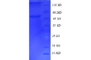 SDS-PAGE (SDS) image for Biphenyl Hydrolase-Like (Serine Hydrolase) (BPHL) (AA 1-274), (Isoform 2) protein (His-SUMO Tag) (ABIN5711487)