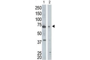 Western Blotting (WB) image for anti-Golgi-Associated, gamma Adaptin Ear Containing, ARF Binding Protein 1 (GGA1) antibody (ABIN3001508) (GGA1 抗体)