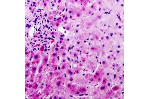 Immunohistochemistry (IHC) image for anti-serpin Peptidase Inhibitor, Clade A (Alpha-1 Antiproteinase, Antitrypsin), Member 5 (SERPINA5) (Center) antibody (ABIN7298574)