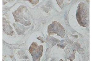 Immunohistochemical staining of formalin-fixed paraffin-embedded human pancreas tissue showing cytoplasmic staining with CARD6 polyclonal antibody  at 1 : 100 dilution. (CARD6 抗体  (C-Term))