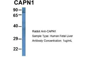 Host: Rabbit  Target Name: CAPN1  Sample Tissue: Human Fetal Liver  Antibody Dilution: 1. (CAPNL1 抗体  (N-Term))