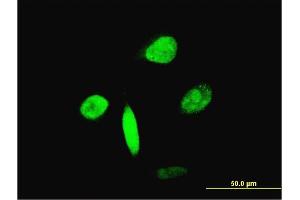 Immunofluorescence of monoclonal antibody to FOXA2 on HeLa cell. (FOXA2 抗体  (AA 363-457))