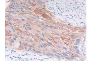 IHC-P analysis of Human Lung Tissue, with DAB staining. (FGFRL1 抗体  (AA 168-378))