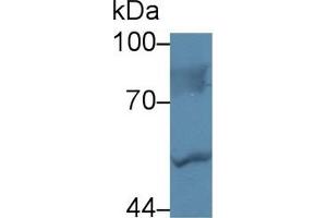 Detection of LBP in Human Hela cell lysate using Polyclonal Antibody to Lipopolysaccharide Binding Protein (LBP) (LBP 抗体  (AA 224-468))