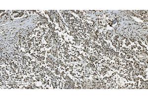 IHC analysis of Transketolase/TKT using anti-Transketolase/TKT antibody (ABIN7598958).
