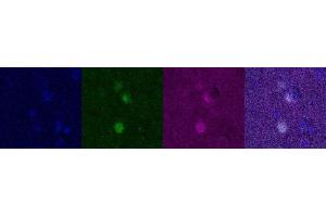 Immunohistochemistry (IHC) image for anti-Oligodendrocyte Lineage Transcription Factor 2 (OLIG2) antibody (ABIN7456250) (OLIG2 抗体)