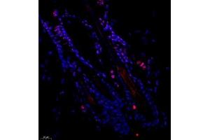 Immunofluorescence of paraffin embedded mouse skin using SRRM2 (ABIN7075555) at dilution of 1:650 (400x lens) (SRRM2 抗体)