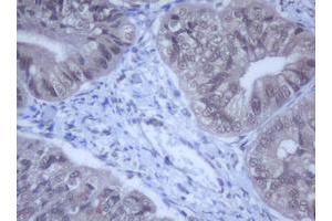 Image no. 13 for anti-DEAD (Asp-Glu-Ala-Asp) Box Polypeptide 59 (DDX59) (AA 1-303) antibody (ABIN1490728)