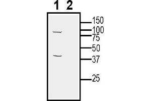 Western blot analysis of rat lung lysates:1.